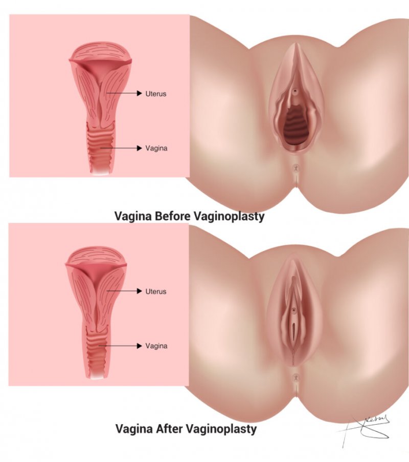 Anatomy of the female vagina
