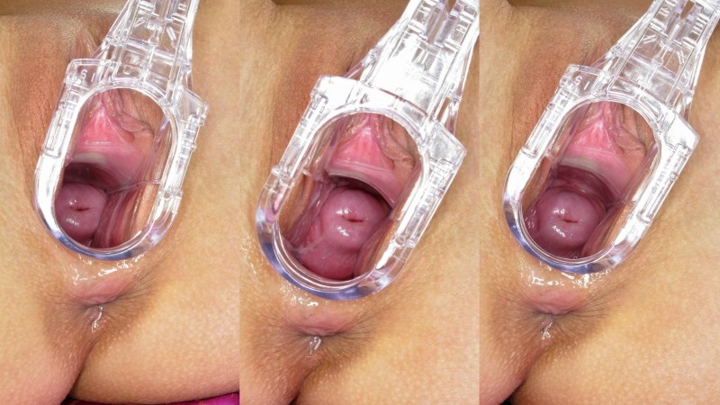 Vaginal expander inside