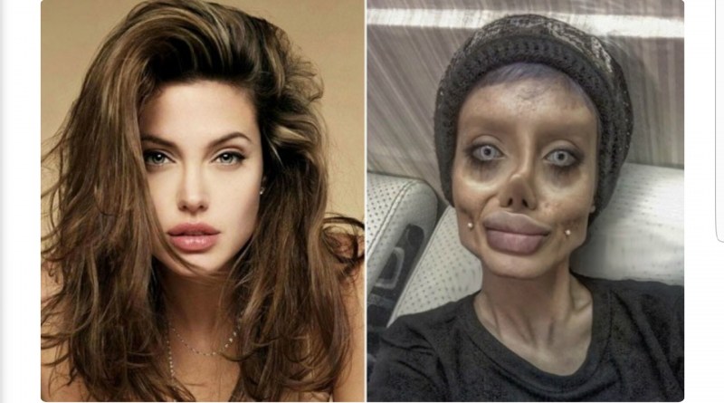 Victims of plastics Angelina Jolie