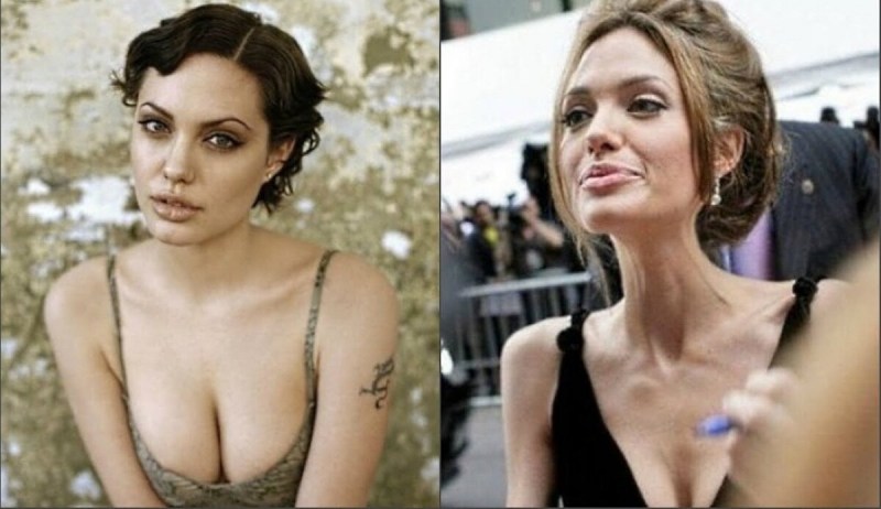 Angelina Jolie is now 2020 anorexia