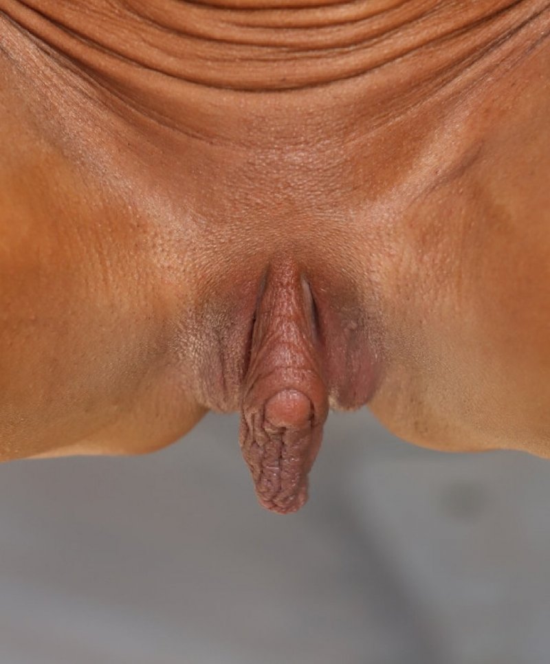 Andie Valentino with the vaginal expander