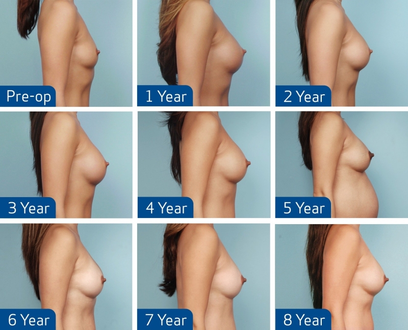 Women's boobs of different sizes