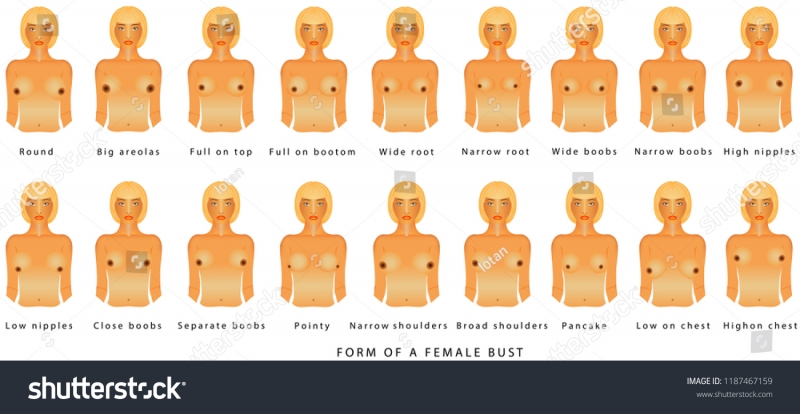Varieties of female breast
